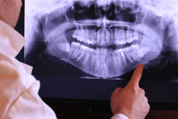 Best Emergency Root Canal Treatment in La Marque, TX